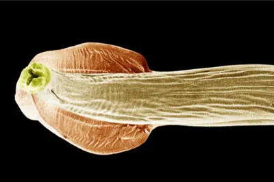 Close-up microscopic view of a dog roundworm (Toxocara canis) segment