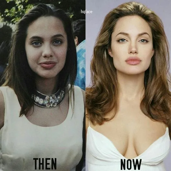 Angelina Jolie with subtle facial enhancements