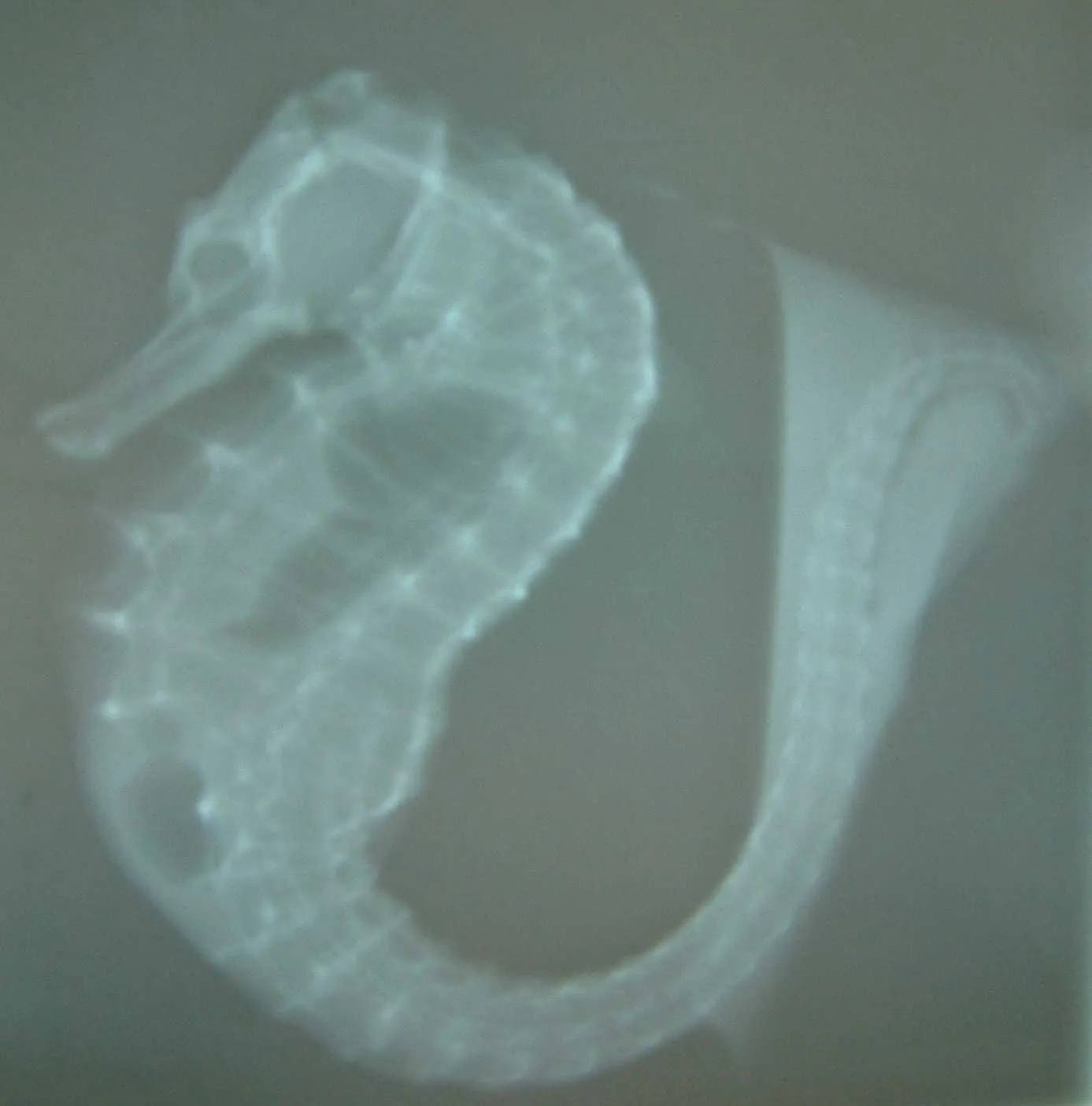 Male seahorse with gas in its brood pouch, visible on a radiograph