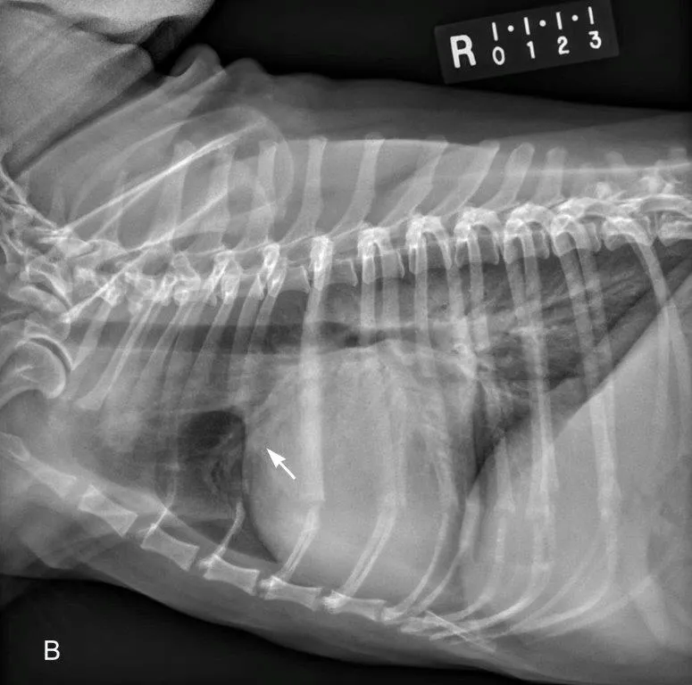 Figure 1B illustration