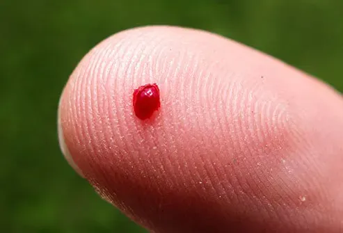 Proper wound care for cuts and burns helps prevent infection and promotes healing